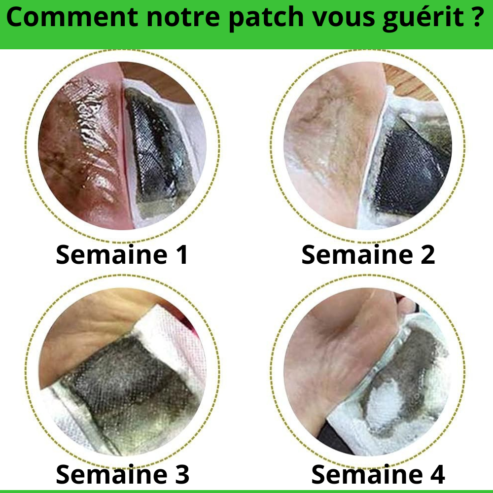 Détox organisme KINOKI
