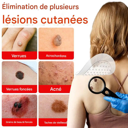 Patch de soin de la peau doux et délicat de haute qualité, nettoyant en douceur, apaisant la peau, réduisant les irritations, maintenant l'hydratation, pour les taches corporelles