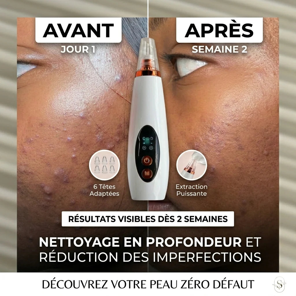 Appareil de nettoyage profond du visage 6 en 1
