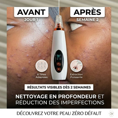 Appareil de nettoyage profond du visage 6 en 1