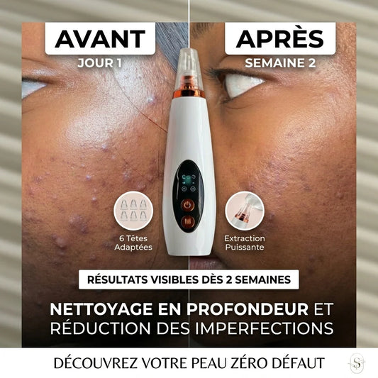 Appareil de nettoyage profond du visage 6 en 1