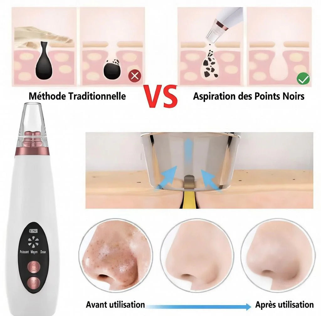 Appareil de nettoyage profond du visage 6 en 1