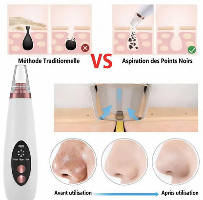 Appareil de nettoyage profond du visage 6 en 1