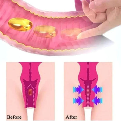 Gélules Bio-Naturelles de réparation vaginale