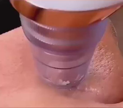 Appareil de nettoyage profond du visage 6 en 1