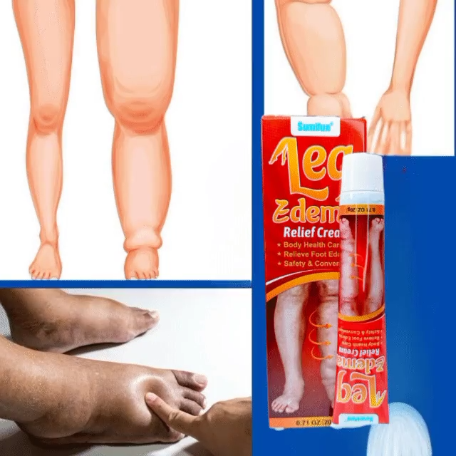 Edema Cream-Soulagement de l’Œdème
